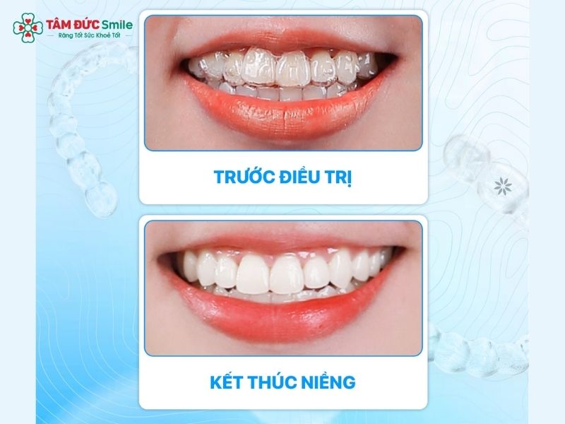 rang-tho-co-nieng-duoc-khong-6