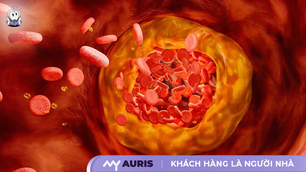 biện pháp bảo vệ hệ tuần hoàn