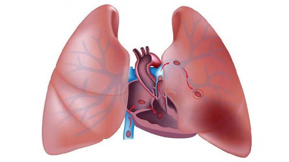 Dung tích sống gắng sức (FVC) là gì?