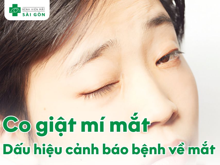 Co giật mí mắt vì sao? Dấu hiệu cảnh báo sức khỏe về mắt