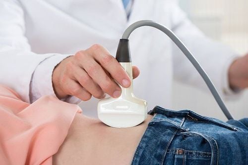 Siêu âm là gì? Những điều cần biết về siêu âm