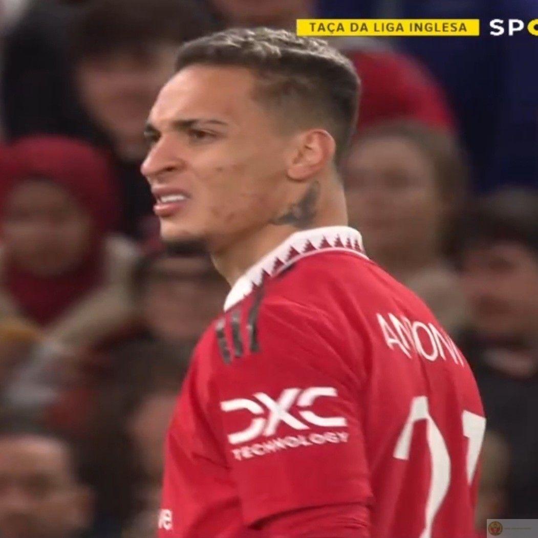 Antony meme face nổi bật bởi những biểu cảm hài hước không lẫn vào đâu được