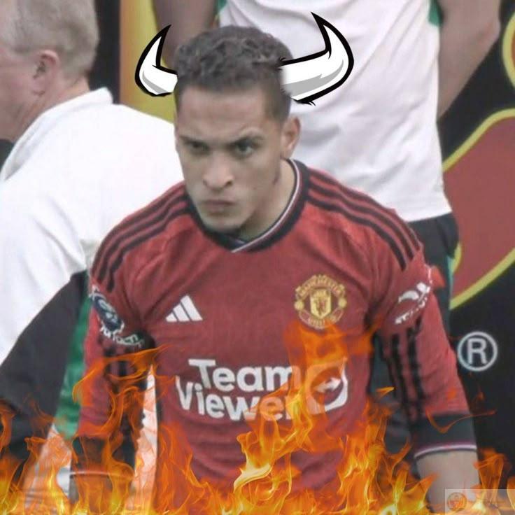 Antony meme face hài hước được lan truyền khắp nơi nhờ độ đáng yêu khó cưỡng
