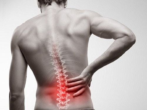 Chụp cộng hưởng từ cột sống thắt lưng khi nào?