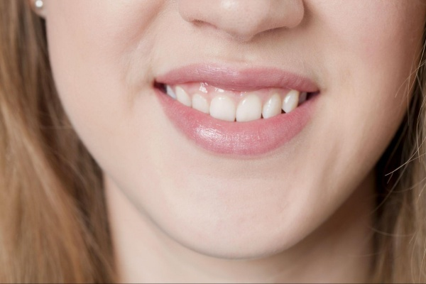 Mất răng có bị lệch mặt không? Cách phòng ngừa thế nào?