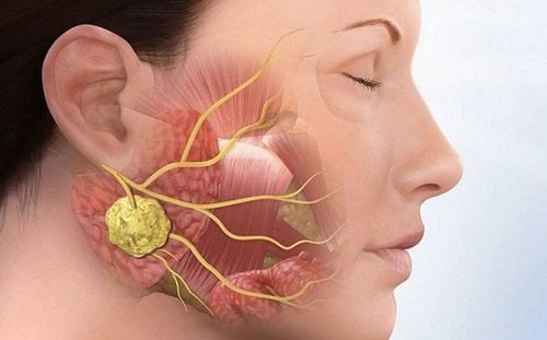 Khối u và u nang đều có thể gây đau 1 bên hàm nhưng tương đối hiếm gặp