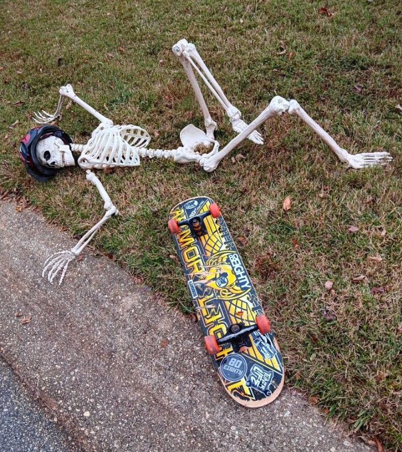 Skeleton ngã