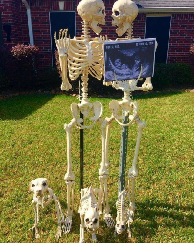 Skeleton Meme – Ảnh Chế Bộ Xương Spooky Hài Hước 💀