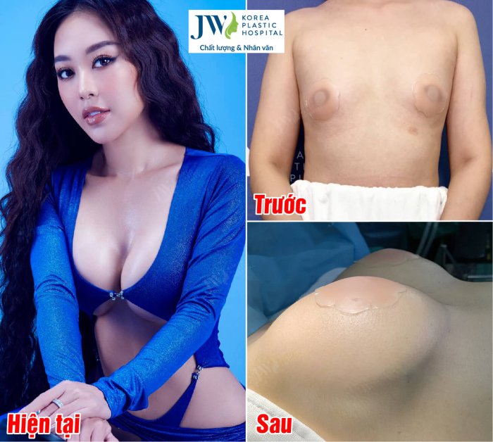 nang-nguc-jw-6