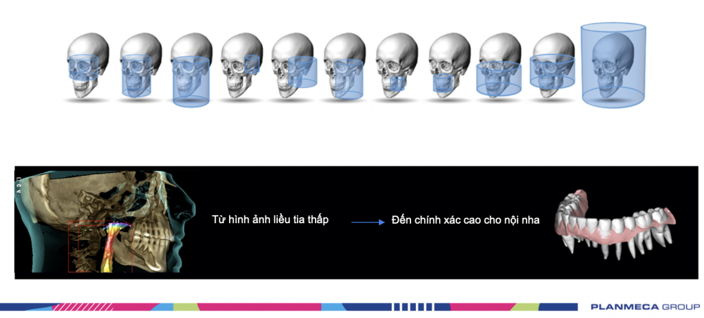 Planmeca-đa-dạng-FOV