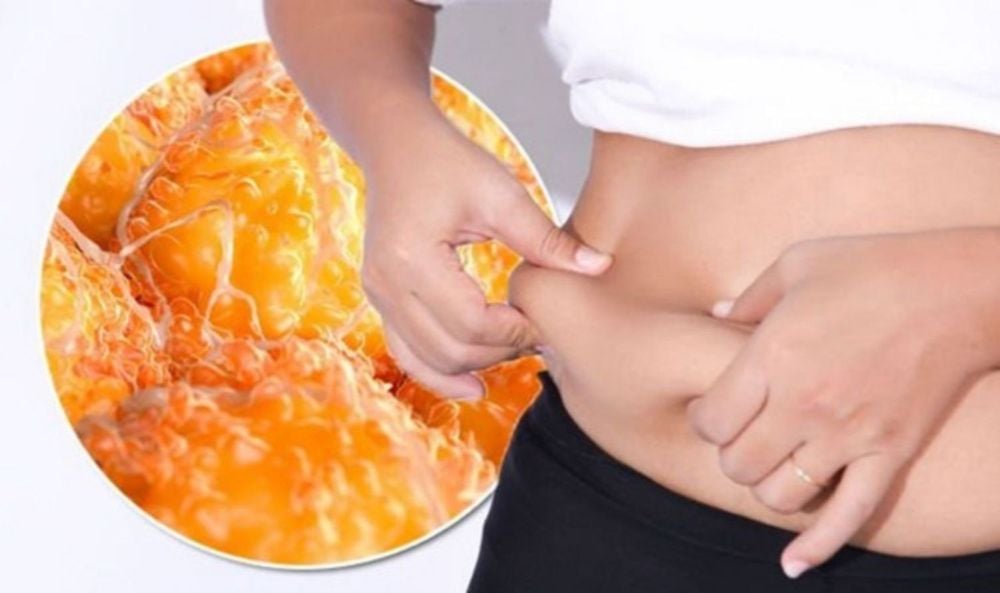 Để xác định có nhiều lớp mỡ dưới da hay không, bác sĩ sẽ chỉ định đo chỉ số khối cơ thể.