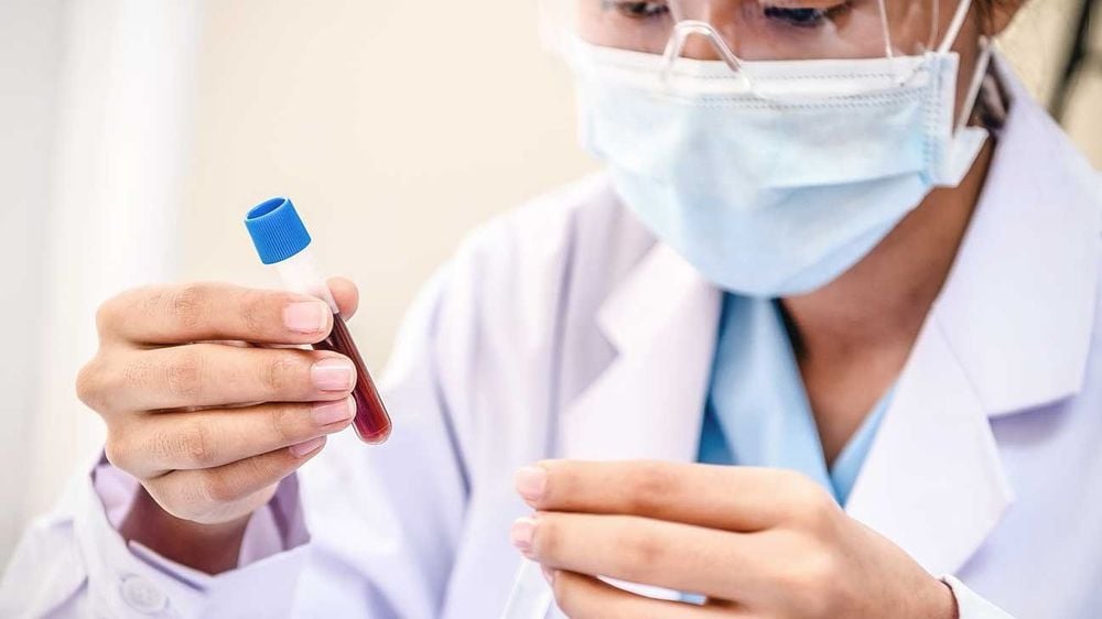 Nhịn ăn, nhịn uống trước khi xét nghiệm máu tổng quát