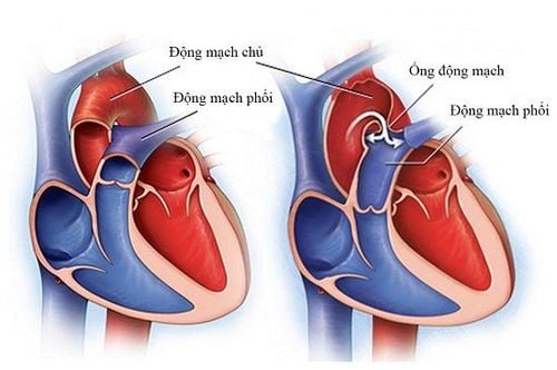 Cách trái tim hoạt động và bơm máu khắp cơ thể