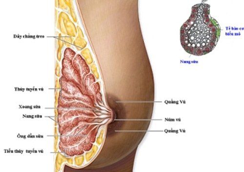 Nhiễm trùng vú là nguyên nhân dẫn đến núm vú bị chảy máu