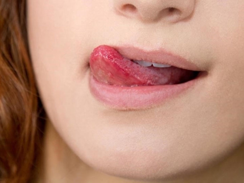 Những thói quen gây thâm môi cần tránh xa để đánh son đẹp hơn