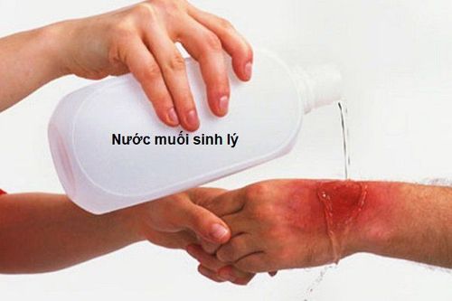 Cầm máu và làm sạch vết thương là 2 bước quan trọng giúp ngăn ngừa nhiễm trùng