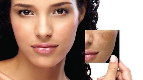 Cách giúp bạn làm đều màu da