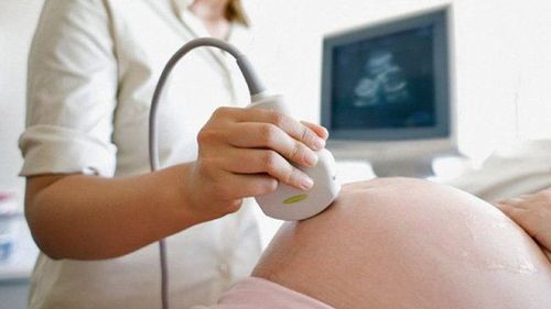 Siêu âm Doppler được sử dụng để kiểm tra lưu lượng máu trong động mạch rốn