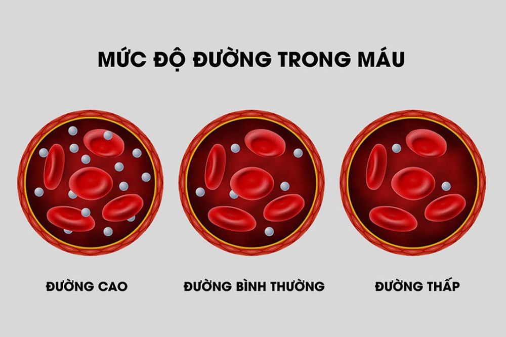 Bệnh tiểu đường ở phụ nữ: Triệu chứng và các rủi ro