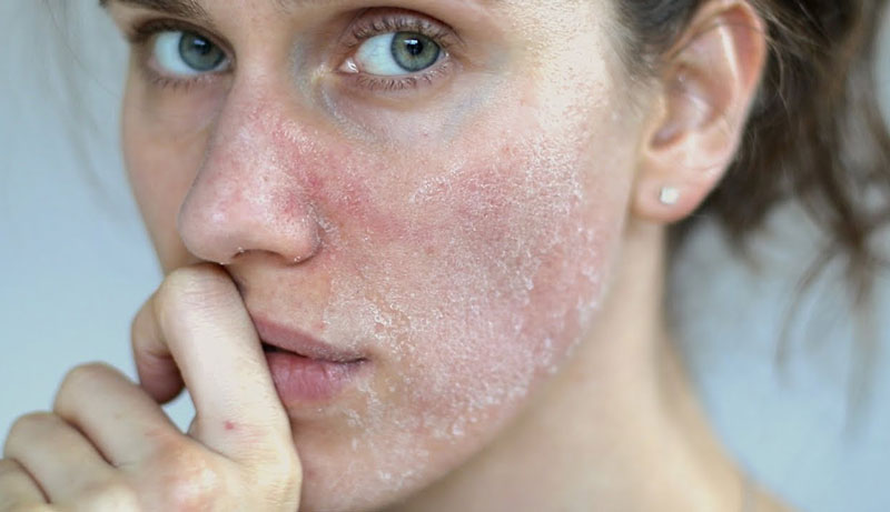 Emulsion là gì? Dành cho những ai? 4