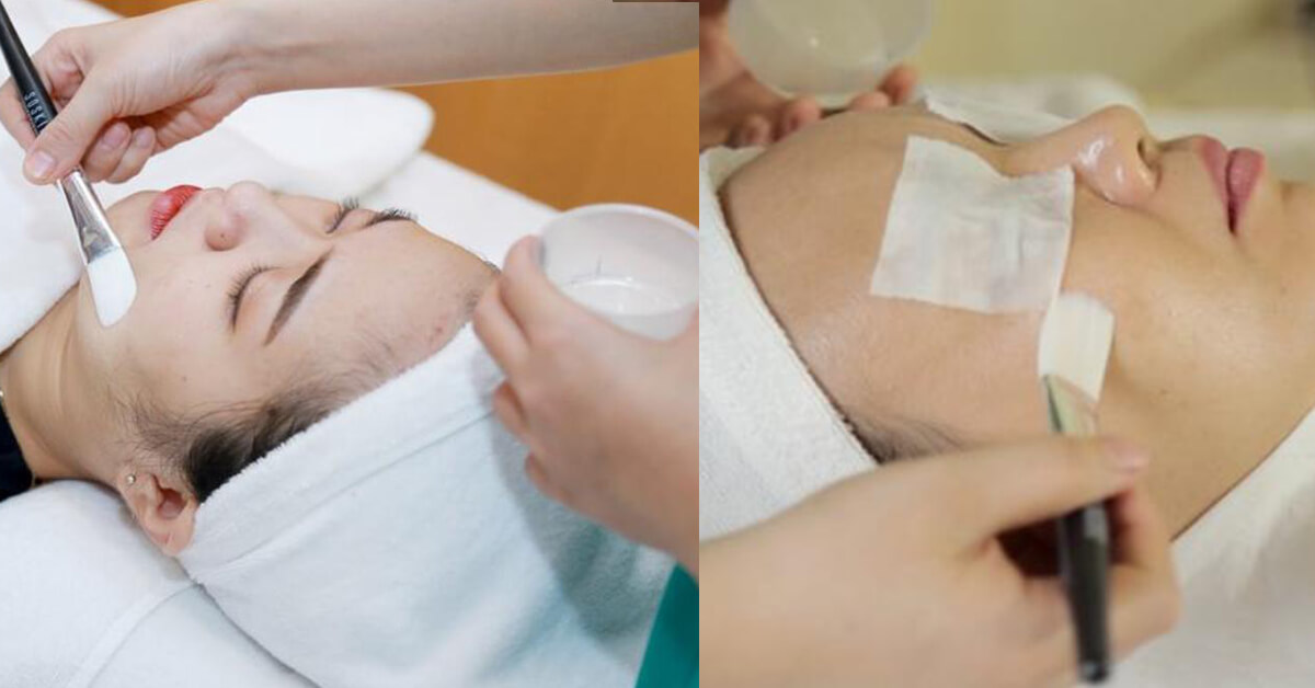 Liệu trình peel tại Phòng khám TTClinic