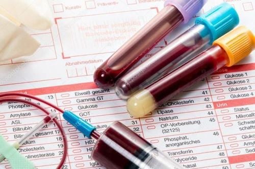 Chẩn đoán bệnh thiếu máu hồng cầu nhỏ nhược sắc với xét nghiệm công thức máu toàn phần - CBC