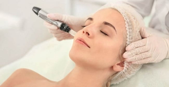 Cách trị tăng sắc tố da bằng liệu pháp laser
