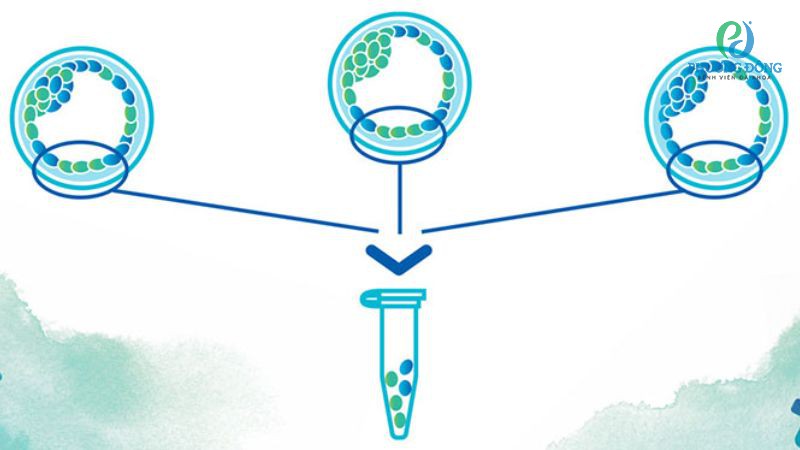 Nguyên nhân tăng hình thành phôi khảm trong IVF
