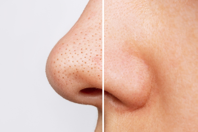 Mẹ bầu có dùng được mặt nạ đất sét không 4