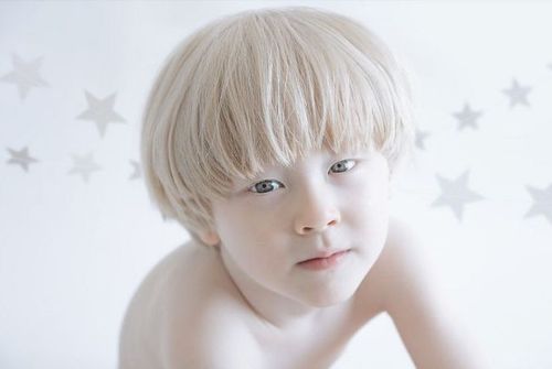 Melanin là gì? Các loại và những rối loạn liên quan