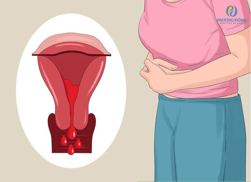 Khi có các biểu hiện đi kèm ở trên nên gặp bác sĩ khám bệnh