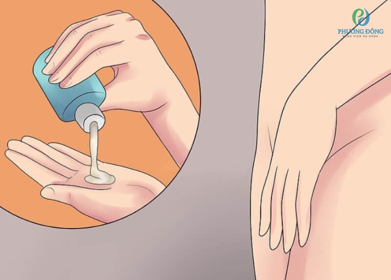 Cần phải có thói quen sinh hoạt khoa học và lành mạnh để không bị viêm nhiễm
