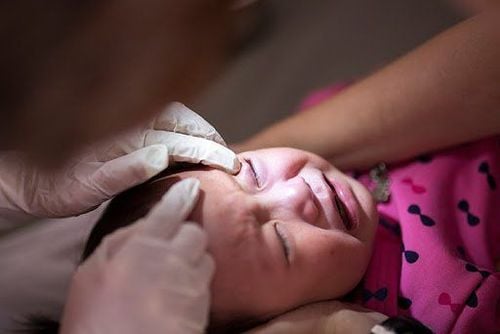 Bố mẹ cần đưa trẻ đến cơ sở y tế khám nếu thấy xuất hiện quầng thâm dưới mắt bé