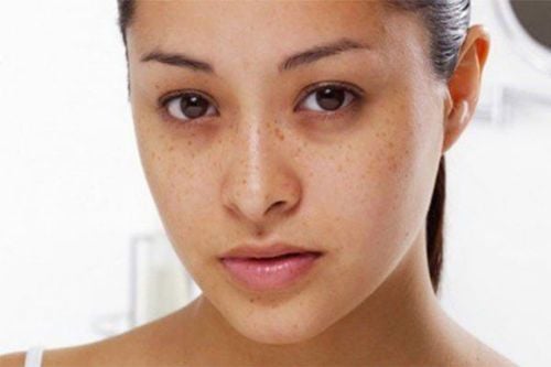 Mắt bé bị thâm quầng, có gì bất thường không?