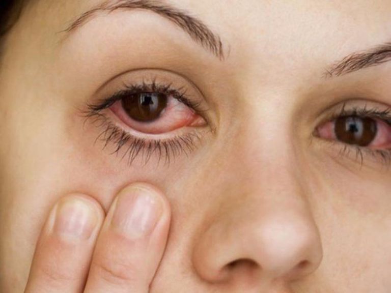 đang cho con bú bị đau mắt đỏ mẹ cần phải đi khám mắt sớm
