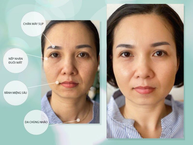 Trần Thanh Tâm amp;#34;trứng rán cần mỡamp;#34; đầy thu hút ở góc nghiêng - 11