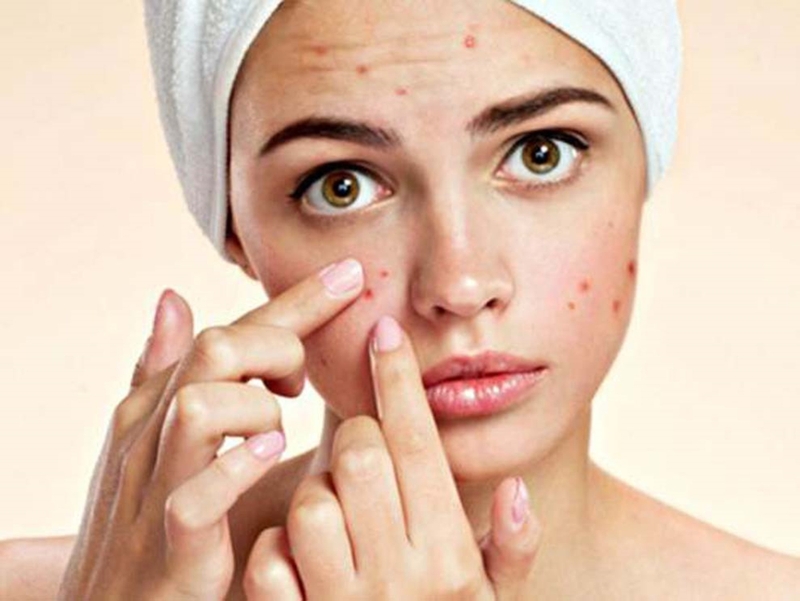 Một số cách để trở nên xinh đẹp ở tuổi dậy thì ngay tại nhà