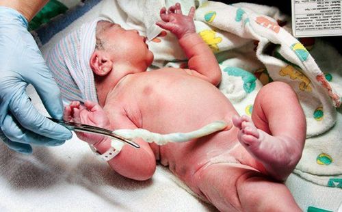 Tế bào gốc máu cuống rốn đã được dùng điều trị trên 80 bệnh