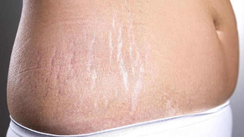 Sau sinh 1 tháng dùng kem dưỡng da được không? Những điều mẹ cần biết