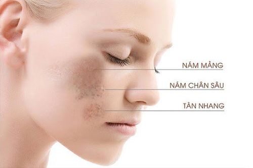 Những điều cần biết về việc kết hợp Niacinamide và Retinol