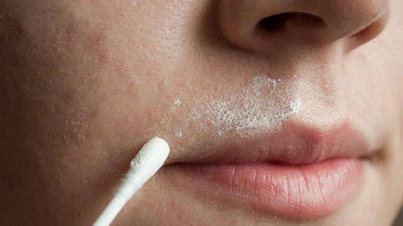 Cách triệt ria mép vĩnh viễn không để lại vết thâm 2