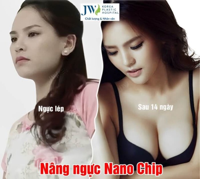 nang-nguc-jw