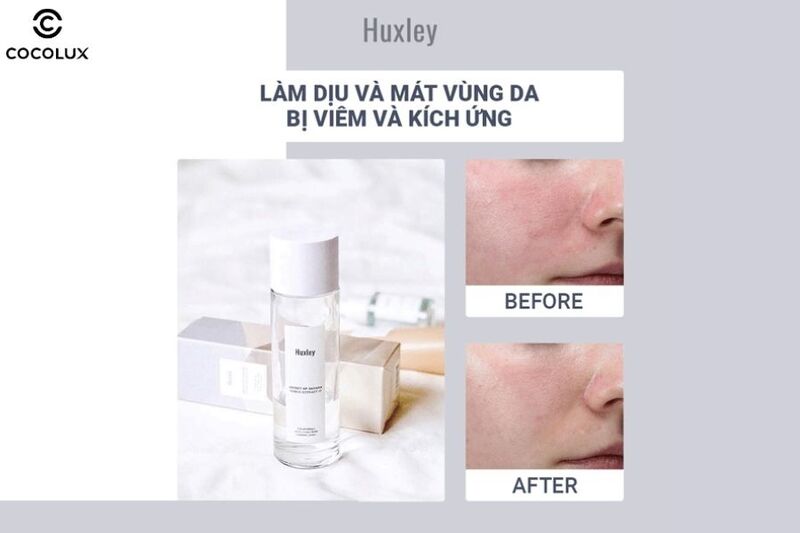 Công dụng làm dịu da của Toner Huxley