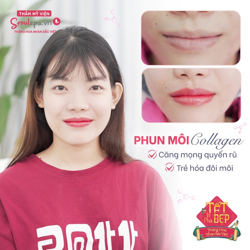 Sau khi phun môi collagen màu đỏ cam tại Thẩm mỹ viện SeoulSpa.Vn mang lại màu môi tươi tắn