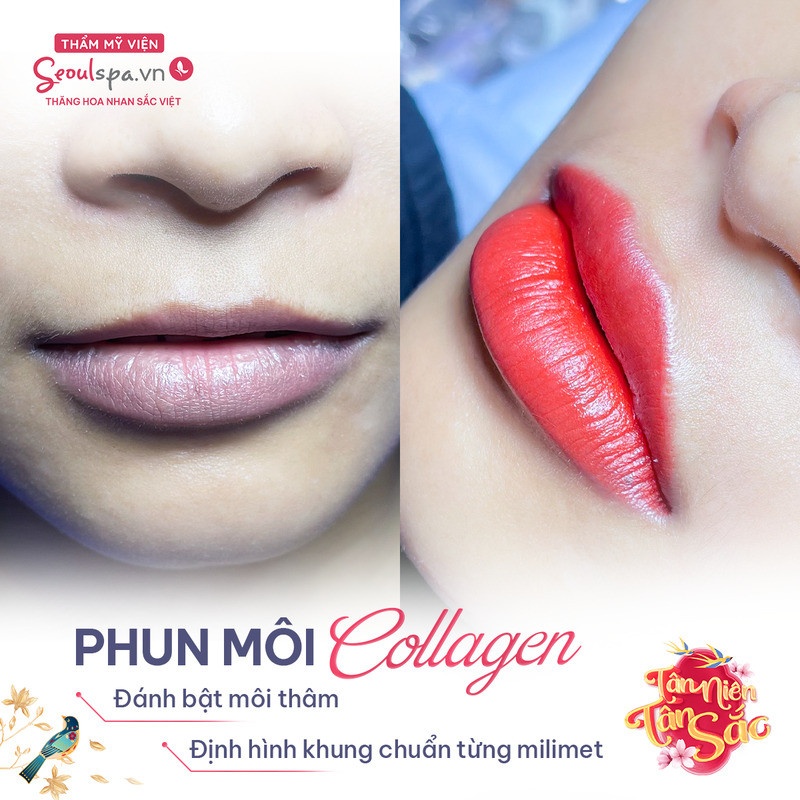 Kết quả phun môi collagen đỏ cam đẹp như ý