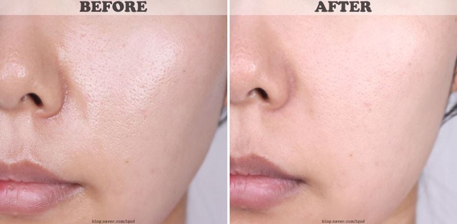 Gel Rửa Mặt Bioderma Ngăn Ngừa Mụn Cho Da Dầu Sebium Gel Moussant