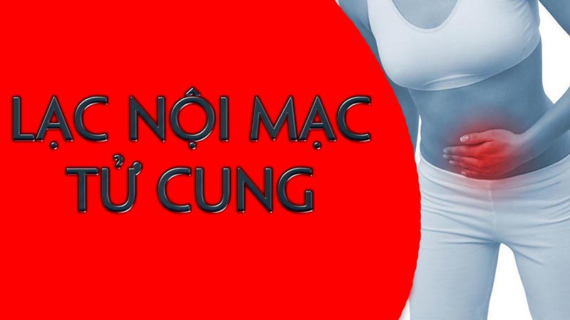 Nữ giới đối mặt với viêm lạc nội mạc tử cung thì nguy cơ đối mặt với vô sinh thứ phát rất cao