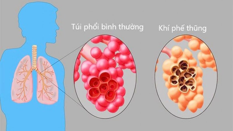 Tin tức