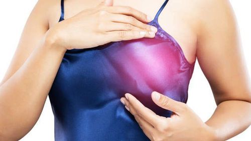 Nếu chụp nhũ ảnh 2 lần mà vẫn nghi ngờ ung thư, bác sĩ có thể chỉ định bệnh nhân sinh thiết vú để khẳng định chẩn đoán