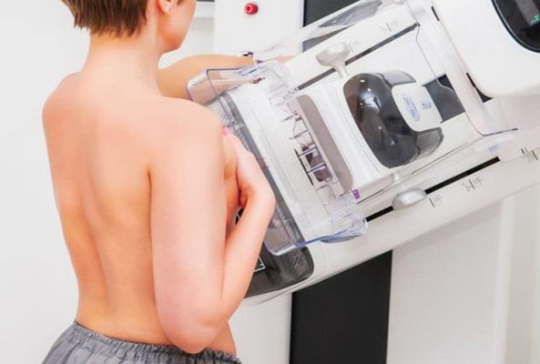 Vôi hóa tuyến vú trên nhũ ảnh